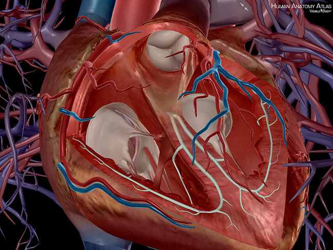 3D printing heart