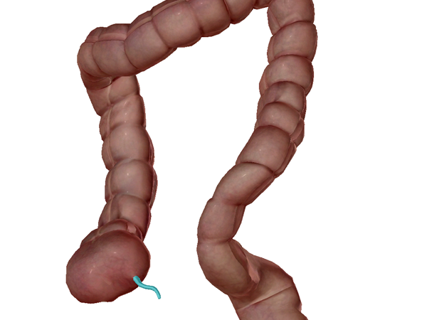 Appendix appendectomy colon large intestine digestive ap vocab