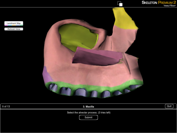 Maxilla Bone Alveolar Process Quiz resized 600