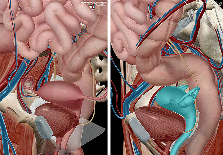 uterine gonads ovum fimbriae fallopian tubes